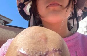 Continúa sin recibir justicia Marlen, atleta de 15 años atropellada por un Transfuturo en Ensenada